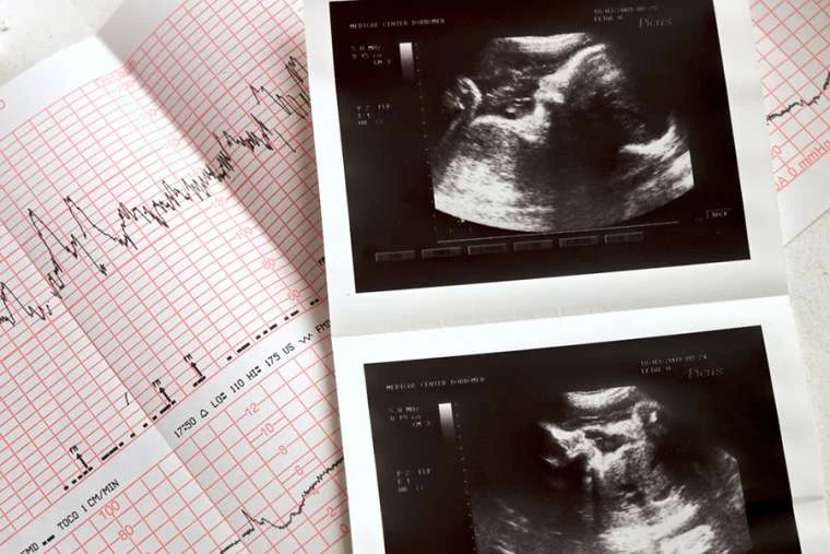 A Georgia woman gave birth to a 1-pound, 16-ounce baby boy on June 13, 2025, after four months on life support.?w=200&h=150